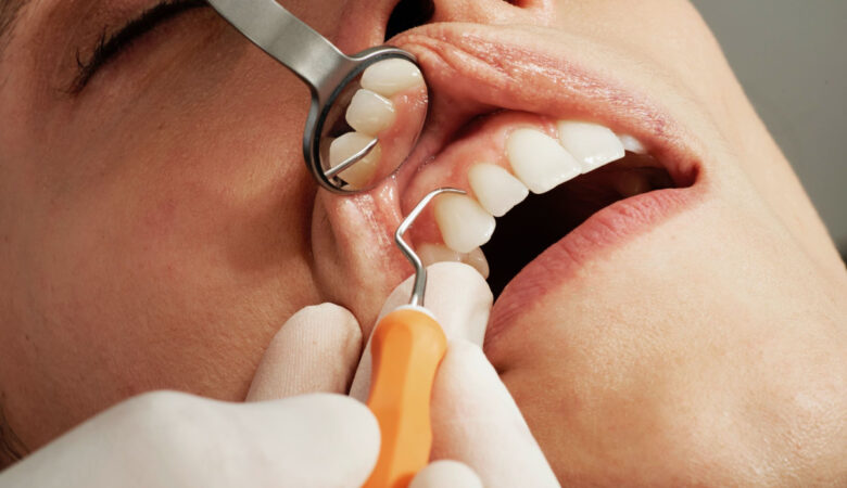 Kan det betale sig at gå til tandlæge i udlandet